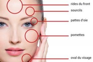 redim-zones-de-traitement-du-visage-par-hifu-finesse-rhxhm